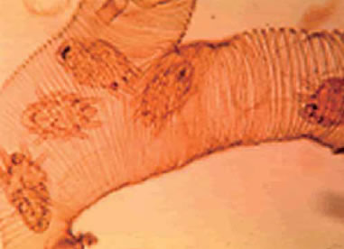 気管内で増殖するアカリンダニ。写真提供：アメリカ農務省